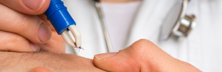 Understanding Tick Bites: When to Seek Medical Treatment 