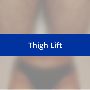 Image for /media/qx4o2iww/thigh-lift.png
