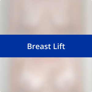 Image for /media/qz0lsexi/breast-lift.png