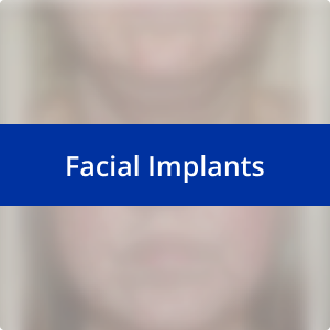 Image for /media/r1hdwjzu/facial-implants.png